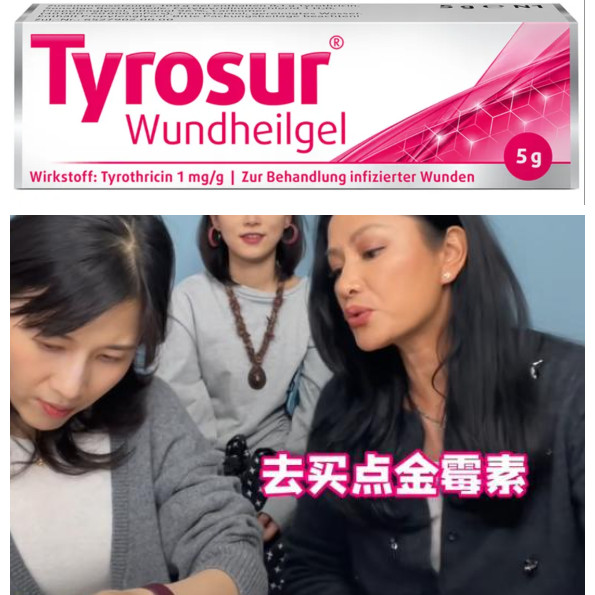 耳朵带便宜耳钉会过敏？来买金霉素！瞿颖同款金霉素药膏